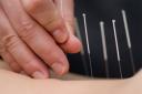 acupuncture500.jpg